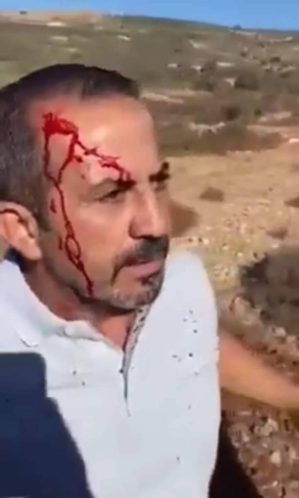 وائل عويس بعد إصابته في الرأس جرّاء اعتداء الجنديّ عليه