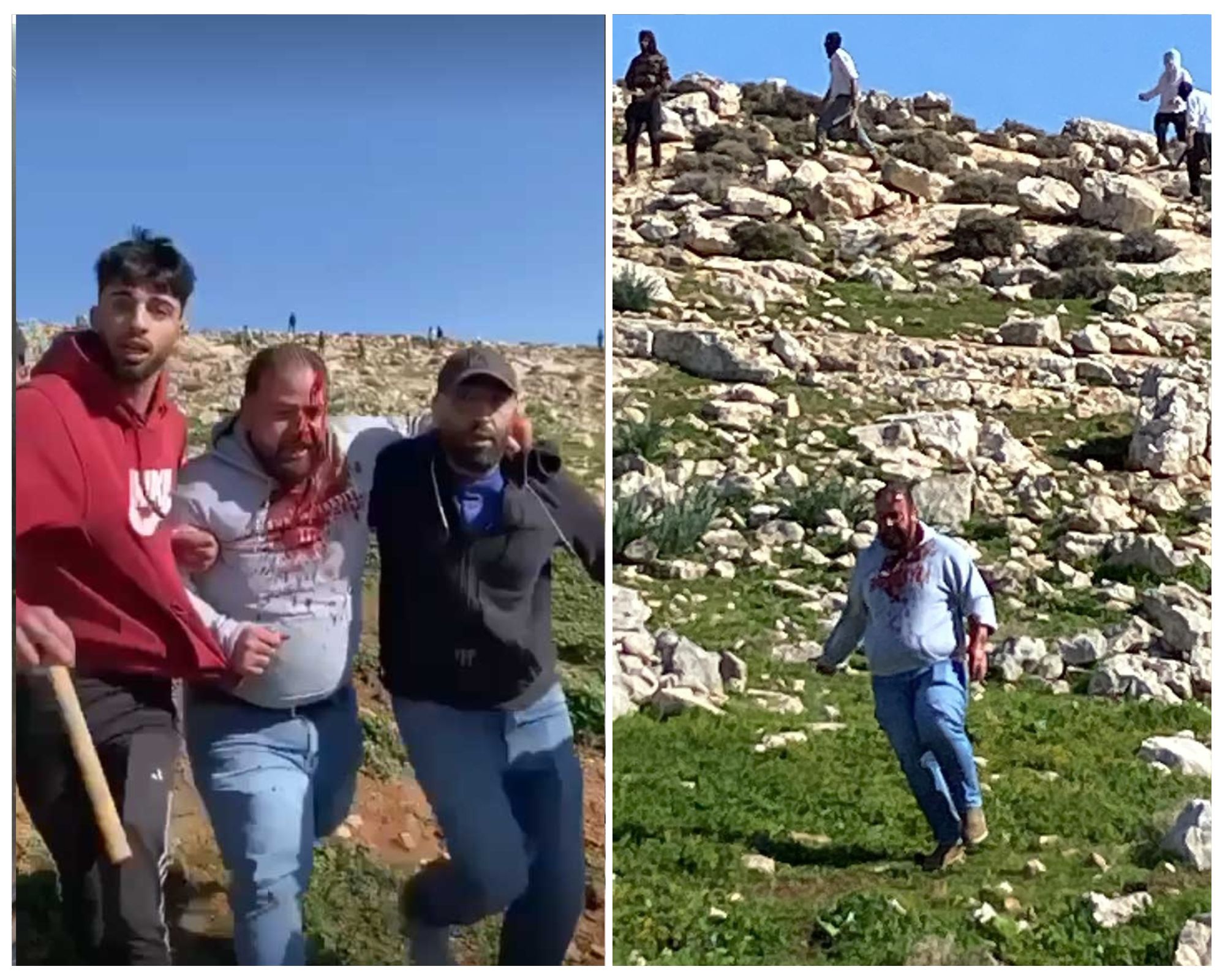 ראג'י ג'אבר לאחר תקיפתו בידי המתנחלים. התמונה באדיבות הרועים 