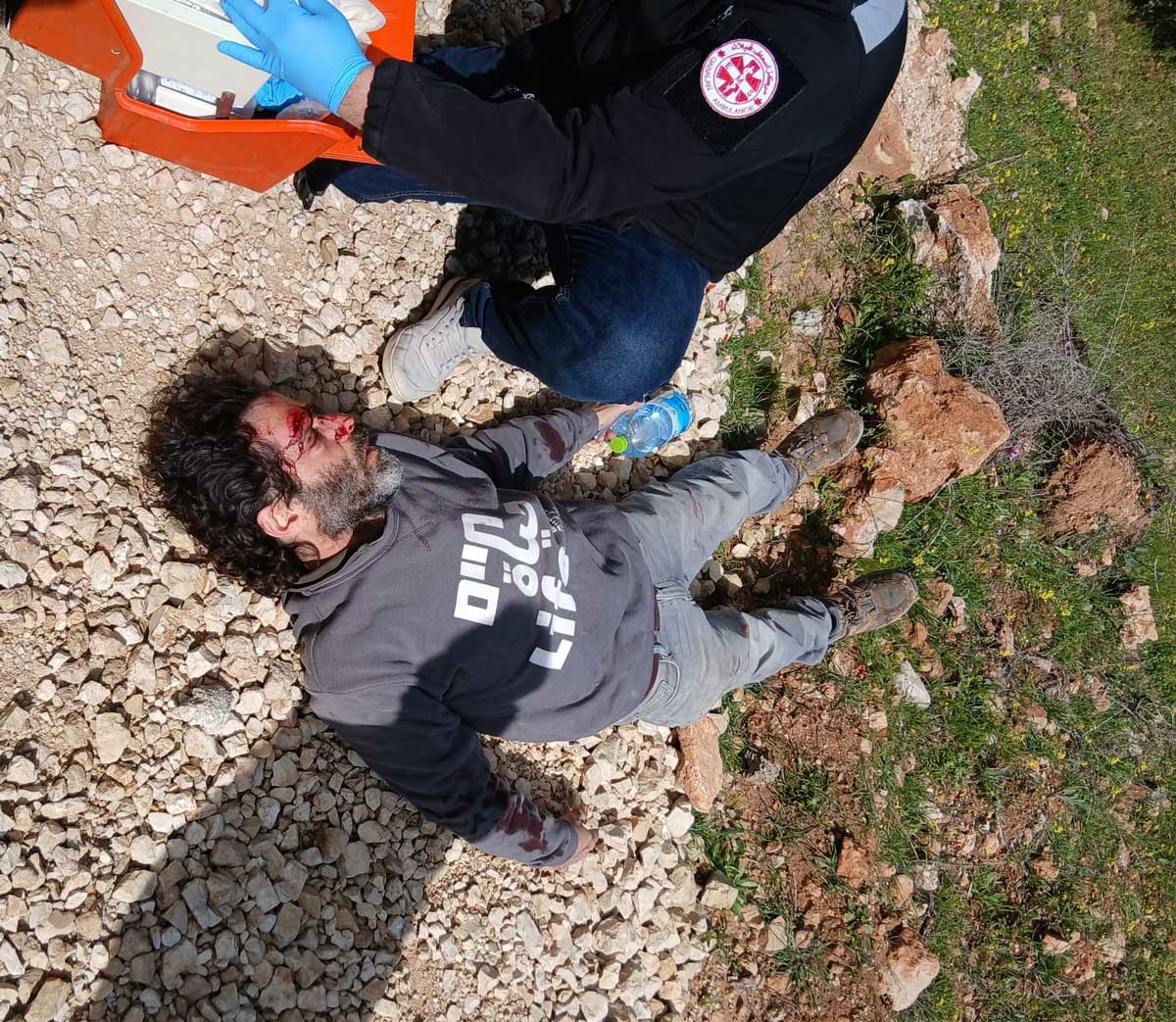 Oded Paporish after the assault. Photo courtesy of the activists