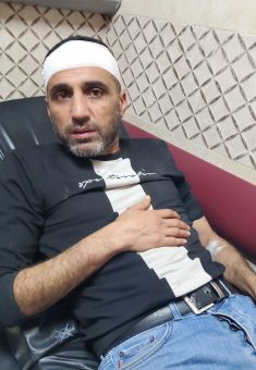 أحمد هاشم بني جابر الذي أصيب في رأسه. الصورة قدمها السكان مشكورين