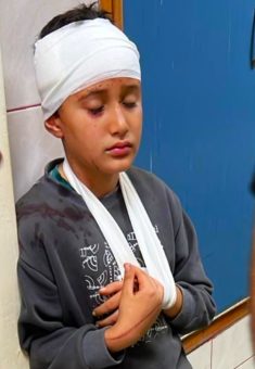 מוחמד אבו זינה לאחר פציעתו. התמונה באדיבות המשפחה