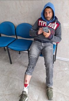 إسماعيل حميد، بعد إصابته. تصوير: سلمى الدبعي، بتسيلم