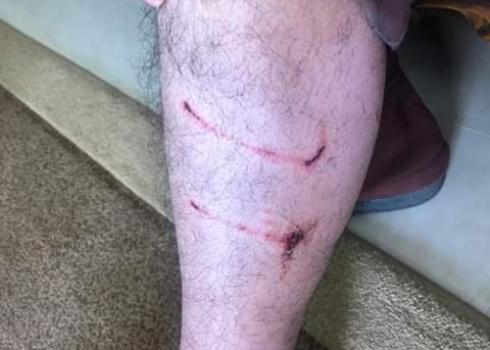 رجل إسماعيل حلايقة الذي عضه كلب أثناء الحدث. الصورة بتفضل من العائلة