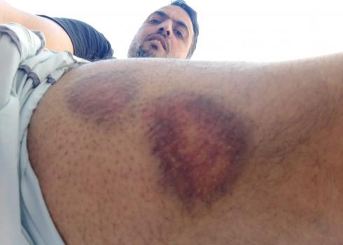 عبد الفتاح صالح بعد أن أغار مستوطنون على أرضه، 7.4.20