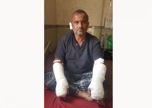 جهاد جازي الذي أصيب إصابة بالغة أثناء فراره من المستوطنين الذين كانوا قد هاجموه. الساوية، 1.11.20. تصوير: سلمى الدبعي، بتسيلم