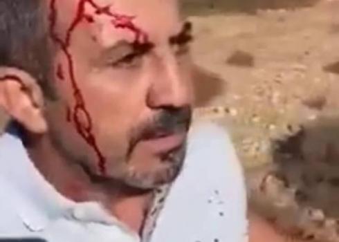 وائل عويس بعد إصابته في الرأس جرّاء اعتداء الجنديّ عليه