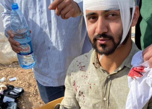 Mu’tasem Mashani after his injury. Photo courtesy of witnesses to the incident  