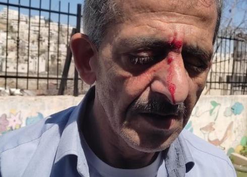 Zidan Sharabati after the assault. Photo courtesy of the volunteers