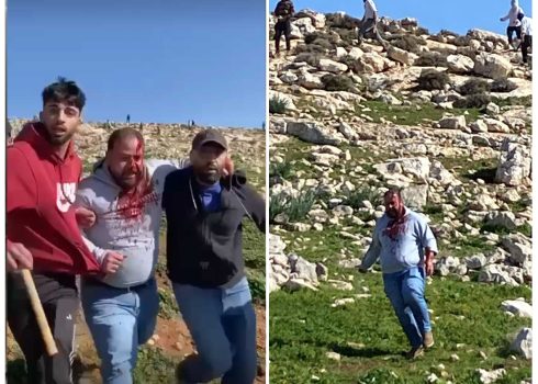 ראג'י ג'אבר לאחר תקיפתו בידי המתנחלים. התמונה באדיבות הרועים 