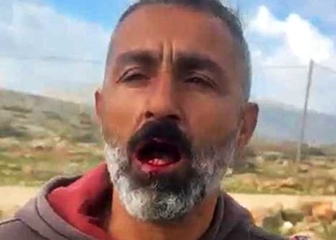 عبد الله الشيخ بعد اعتداء المستوطنين عليه. الصورة قدمها السكان مشكورين