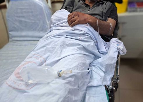 غنّام الفقير في المستشفى بعد الاعتداء عليه، مباشرة. تصوير: عارف دراغمة، بتسيلم  