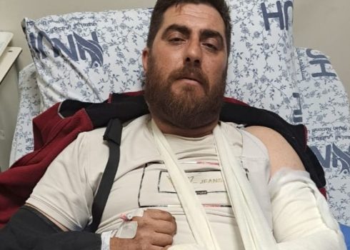 حسني فرعونية في المستشفى بعد اعتداء المستوطنين عليه في أرضه. تصوير: سلمى الدبعي، بتسيلم  