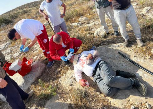 נעים חמאמדה מטופל לאחר תקיפתו. צילום: באסל אל-עדרה, בצלם