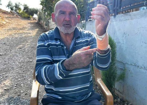 איבראהים ר'נימאת לאחר תקיפתו. צילום: באסל אל-עדרה, בצלם