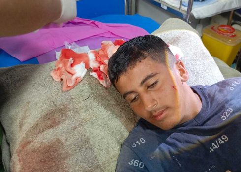 חבישת ראשו של מוסעב סוואטפה במרפאה. צילום: עארף דראר'מה, בצלם