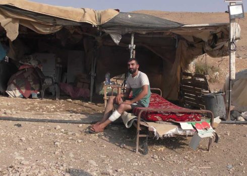 מוסטפא דראר'מה לאחר תקיפתו בידי המתנחלים. צילום: עארף דראר'מה, בצלם