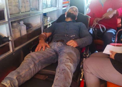 שאדי א-טרווה באמבלונס לאחר שהותקף. התמונה באדיבות התושבים