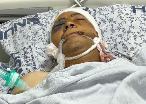 חיכמת שתיווי בבית החולים. התמונה באדיבות המשפחה