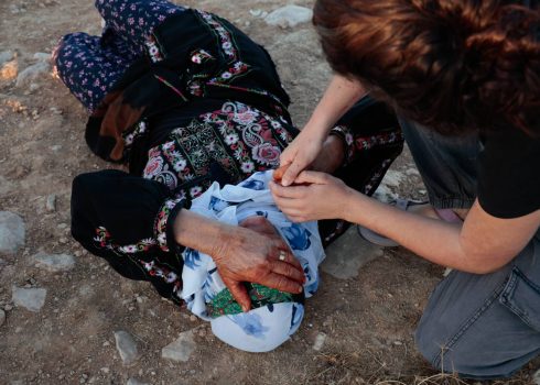 תושבת הכפר שהוכתה בידי המתנחלים ונפגעה מתרסיס הפלפל. התמונה באדיבות תושבים