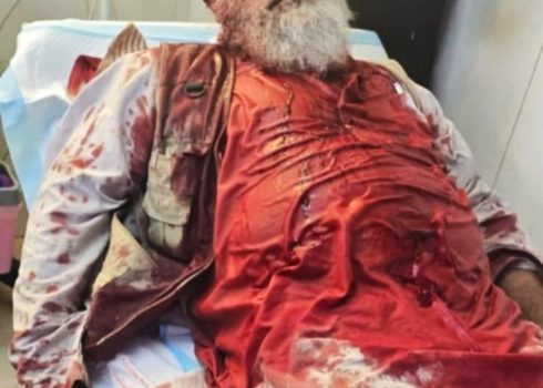 מוסטפא מילחם מטופל בבית החולים. התמונה באדיבותו