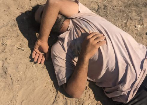 Ayman Daraghmeh after the assault. Photo courtesy of residents