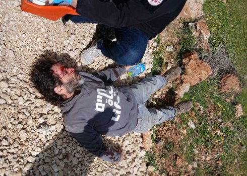 عوديد بابوريش بعد تعرّضه للهجوم. صورة قدّمها الناشطون مشكورين  